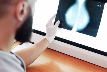 El SES cita a más de 7.600 extremeñas para realizarse mamografías en febrero