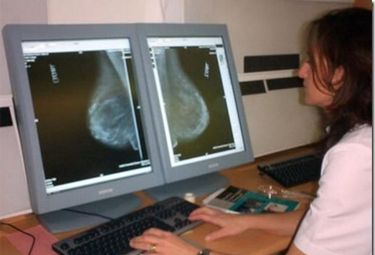 Más de 7.600 extremeñas están citadas para hacerse mamografías en febrero
