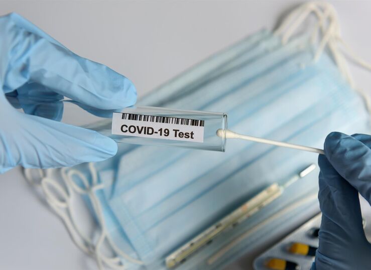 Extremadura ha realizado ms de 664000 pruebas diagnsticas desde el inicio pandemia