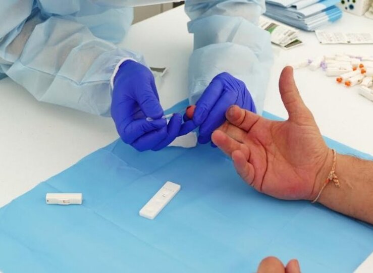 Extremadura ha realizado ya mas de 47100 PCR desde el inicio de la epidemia