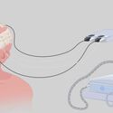 SES compra transductores para tratar con nueva terapia a pacientes con tumor cerebral SES compra transductores para tratar con nueva terapia a pacientes con tumor cerebral