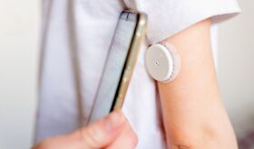 Junta otorga ms de 116M a contratar suministro sistemas monitorizacin continua glucosa