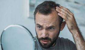 Injerto capilar por qu est creciendo tanto en Andaluca y Extremadura