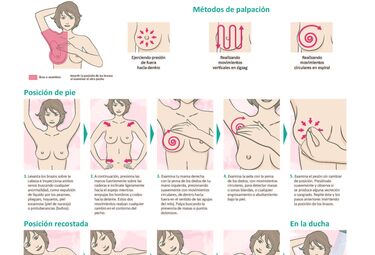 Autoexploración mamaria es la principal medida de prevención contra cáncer de mama