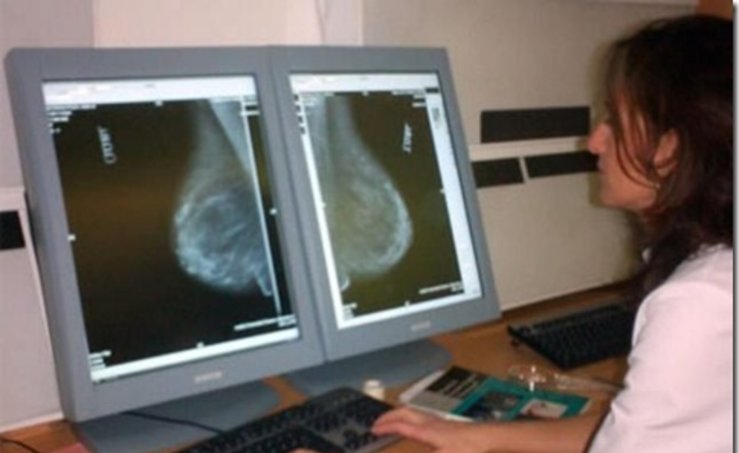 Ms de 6500 extremeas se sometern a mamografas en enero 