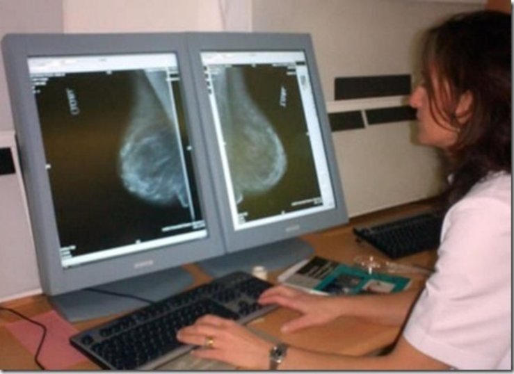 Ms de 7600 extremeas estn citadas para hacerse mamografas en febrero