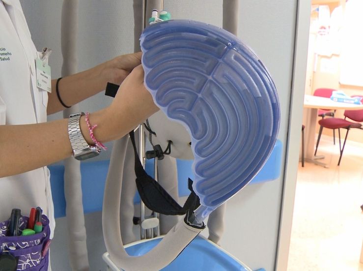 Hospital Mrida aplica tcnica de enfriamiento que evita cada del pelo por quimioterapia