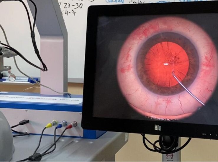 Comienzan a darse ayudas de hasta 100 para gafas y lentillas para menores de 16 aos