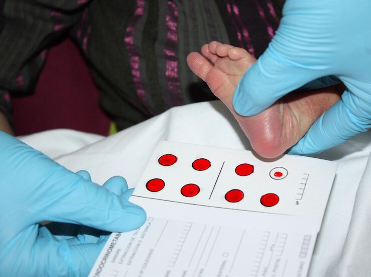 FEDER alerta inequidad en CCAA en acceso pruebas para detectar dolencias en recin nacidos
