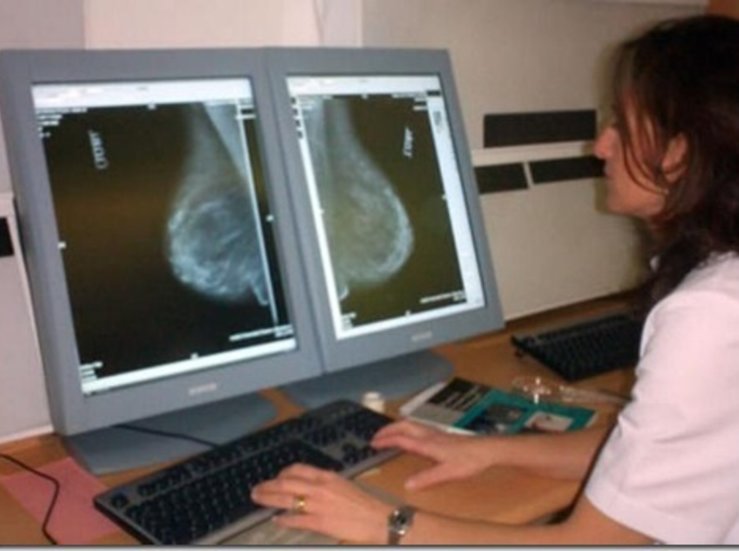 8000 extremeas se sometern a mamografas en octubre