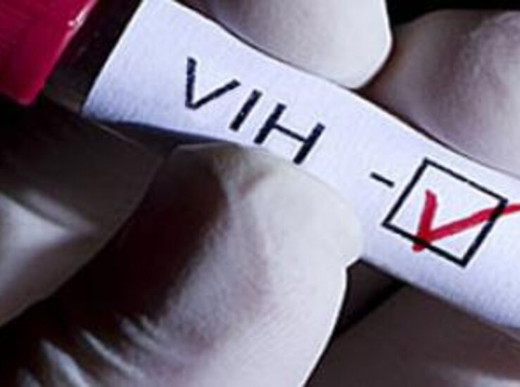 Ms de 1500 personas estn infectadas de VIH en Extremadura
