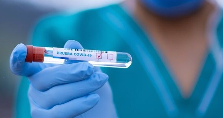 Extremadura registra 81 pacientes de Covid-19 ingresados , 8 en las UCIs